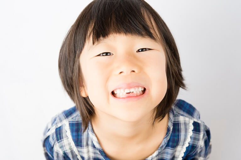 乳歯 子供の歯 がグラグラ なかなか抜けない原因と対処法 おひさま歯科 こども歯科