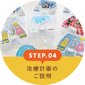 STEP.04 治療計画のご説明